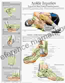 Ankle Injuries E Chart: Quick Reference Guide